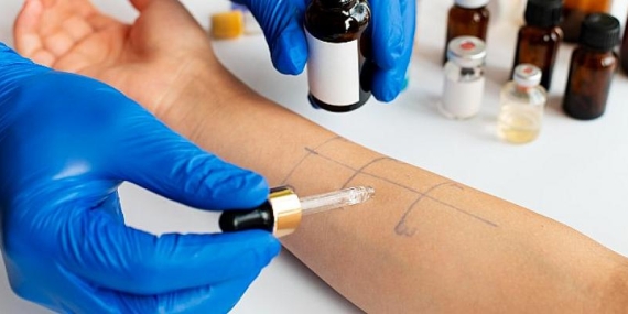 Kene Isırığı, Kırmızı Et Alerjisi Yapıyor