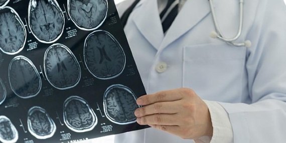 Fizik Tedaviye Erken Başlanılmazsa Felcin Kalıcılık İhtimali Artıyor