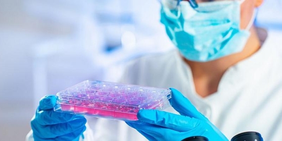 Kıbrıs’ta bir ilk: Kök hücre tedavisi