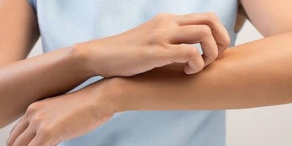 Uyuz vakalarında artış var, gözlerimizi nasıl korumalıyız?