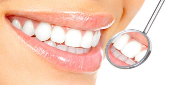 Lazerle Diş Beyazlatma