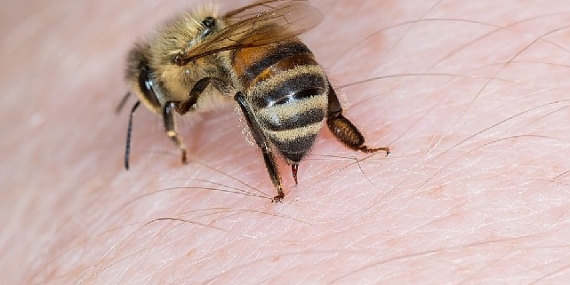 Arı sokmasında Adrenalin Otoenjektörü hayat kurtarıyor
