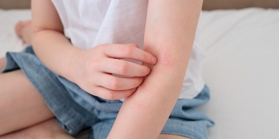 Çocuklarda &apos;Alerjik Hastalıklar' Hakkında Doğru Sanılan 8 Hatalı Bilgi!