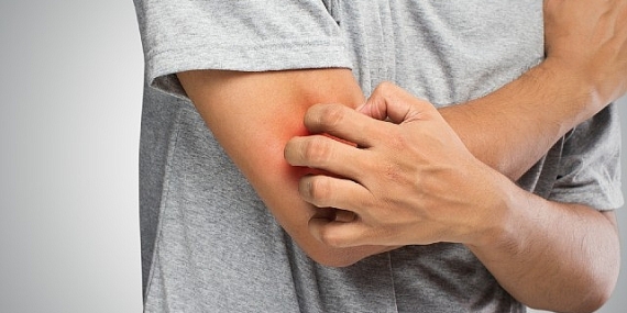 Mantar Hastalığı Hakkında Bilinmesi Gereken 6 Önemli Bilgi!