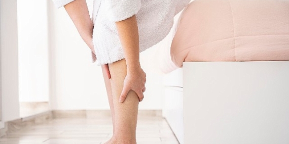 Yazın varis tedavisi olur mu?