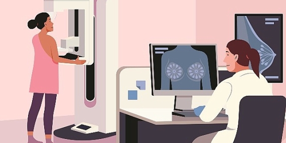 2 Yılda Bir Önlem Amaçlı Mamografi Çekilmeli!