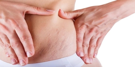 Çatlak Tedavisi: Cilt Sağlığı ve Estetik Görünümün İyileştirilmesi