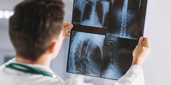 “Dr. Türktemiz; İyonlaştırıcı Radyasyonun Olumsuz Etkilerini Azaltmak Mümkün"