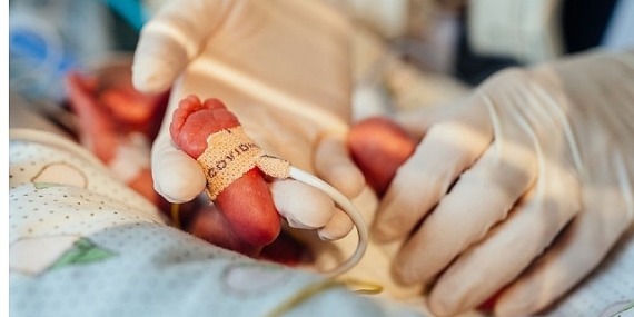 Türkiye'de Doğan Bebeklerin %12'si Prematüre!