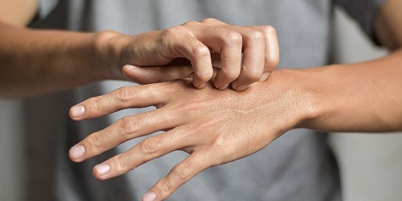 Uyuz vakalarında artış !