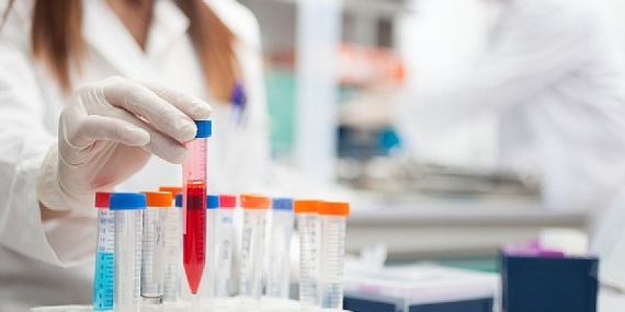 İmmünoterapi hakkında merak edilen 10 soru !