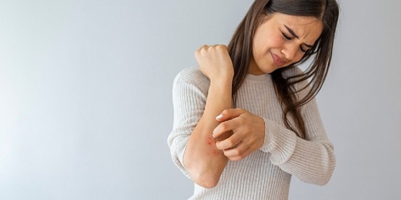 Soğuk Hava ve Rüzgar Egzamayı Tetikliyor!