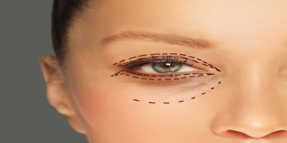 Üst Göz Kapağı Estetiği: Güzellik ve Fonksiyonellik Üzerine Derinlemesine Bir Bakış