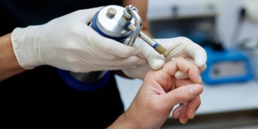 Kriyoterapi Sonrası