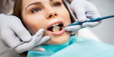 Adeziv Sistemler Nedir?