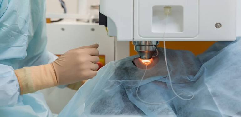 Lazer Göz Ameliyatı